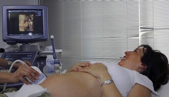 Dom zdravlja: Lekarima broje "višak" uputa za ultrazvuk i rendgen