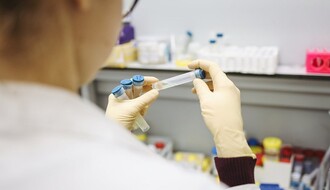 KOVID -19: Serološko testiranje od ponedeljka kod privatnika, a uskoro i PCR test