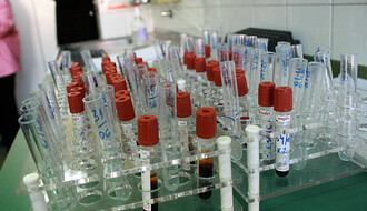 U Srbiji povećan broj HIV pozitivnih osoba