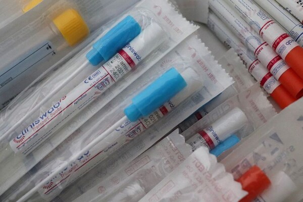 Kućni testovi na korona virus stigli u apoteke u Srbiji, cena oko 1.300 dinara