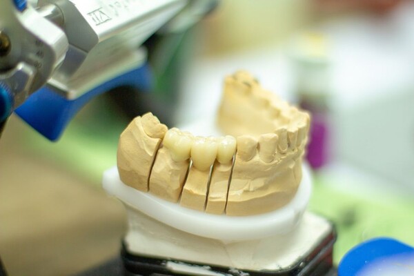 U Domu zdravlja ponovo moguća izrada zubnih proteza