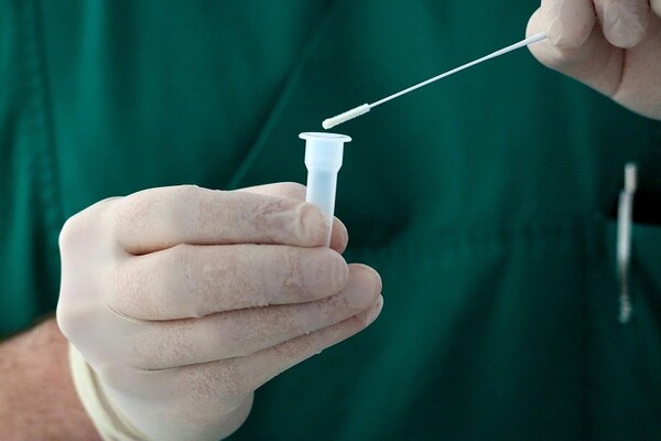 Testovi na korona virus od iduće nedelje u apotekama