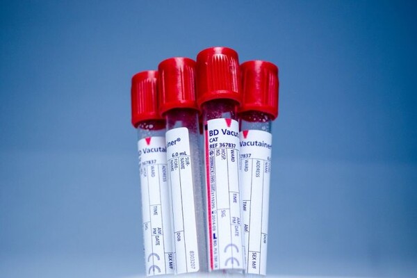 ZAVOD ZA TRANSFUZIJU: Smanjene rezerve A i nulte krvne grupe